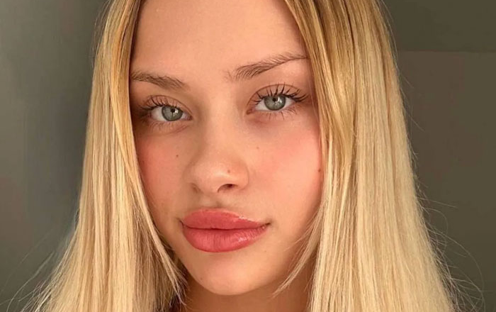 Model Found Brutally Injured on Roadside in Dubai After Attending Alleged “Modeling Party”