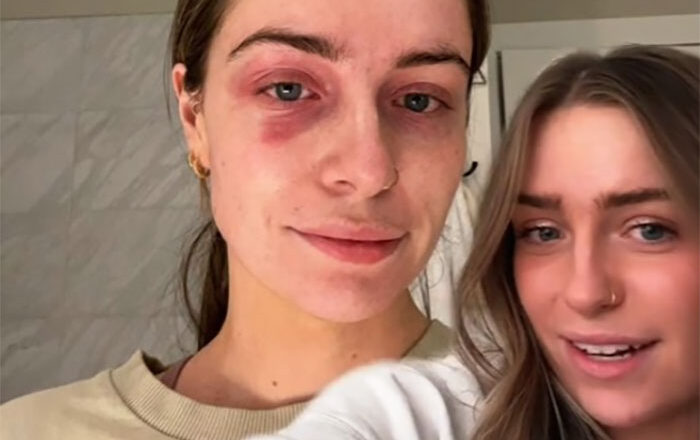 Woman Discovers She’s Been “Poisoning” Herself for Months with ..