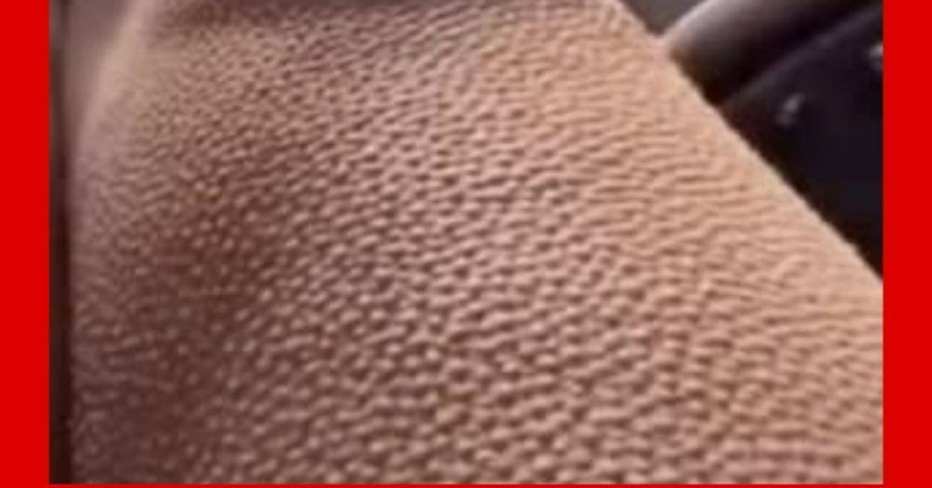 If you get goosebumps for no reasons, it is a clear sign that you are….